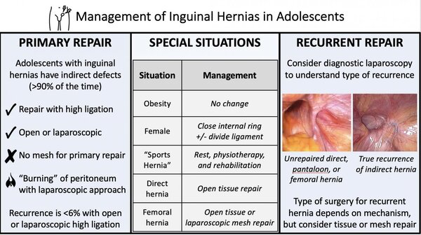 Inguinal hernias