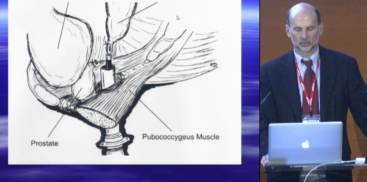 Laparoscopic approach for imperforate anus