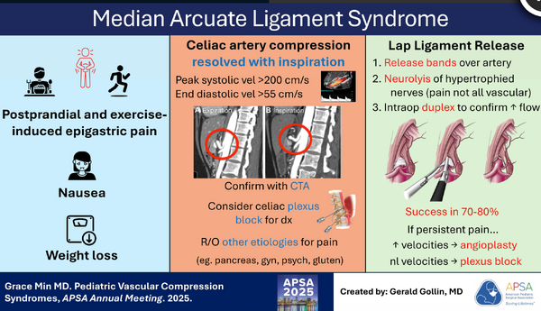 Median arcuate ligament syndrome
