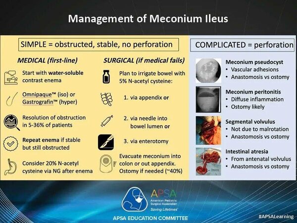 Management of meconium ileus