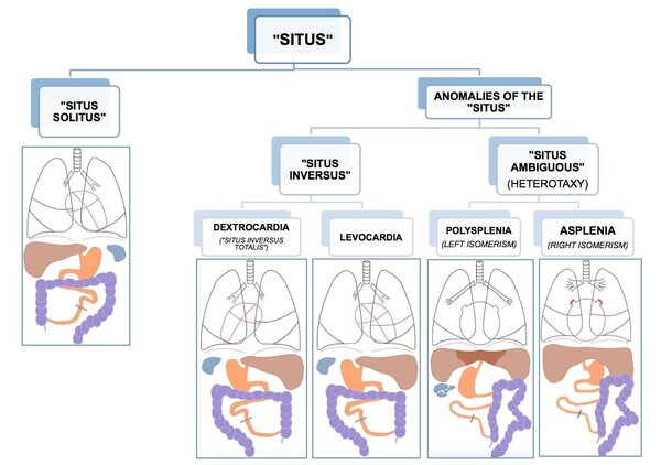 SITUS