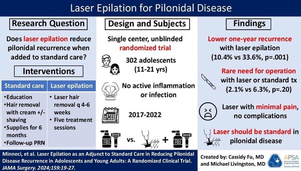 Laser epilation Of Pilonidal disease
