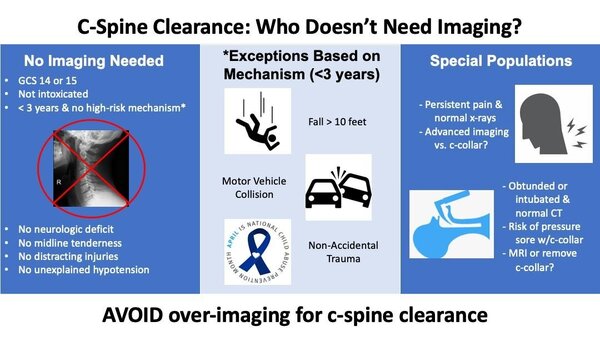 C spine clearance