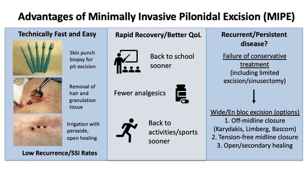Advantages of minimally invasive surgical techniques in pilonidal disease