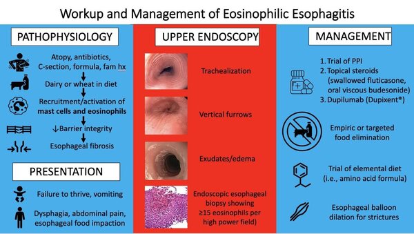 management of eosinophilic esophagitis