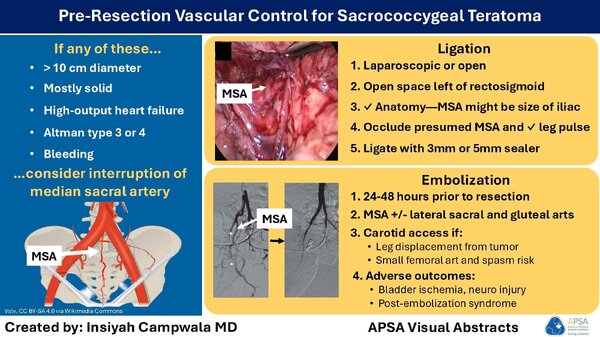 Pre resection vascular control on sacrococcygeal teratoma